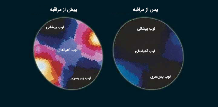 مراقبه چیست و چه اثری بر ذهن ما دارد؟_ستاره شو 34 مراقبه چیست ، تاثیر مراقبه بر مغز